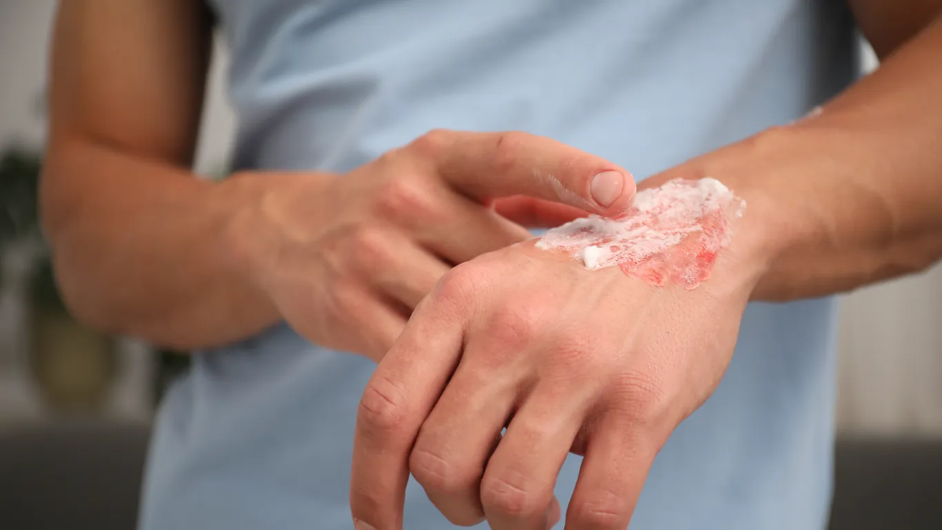 Ointments & Topicals